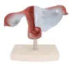 Modelo de curetagem transparente modelo de útero grande natural modelo de aumento uterino útero artificial avançado útero simulado de aborto