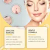 Crema Calmante para el Cuidado de la Piel Fórmula Suave de Plantas Herbales Limpia Calma la Piel Desvanece Imperfecciones Especialmente Cuidado de Lunares