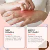 La Crema para el Cuidado de la Piel Ximonth Mejora la Molestia en la Piel y Puede Aplicarse Externamente para Hidratar Suavemente la Piel. Crema de Cuidado Diario