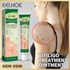 Crema reparadora de piel EELHOE Piel de manos y pies Crema reparadora de musgo Piel hidratante suave Crema reparadora de piel Cuidado externo