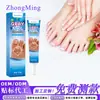 Zhongming Amazon Transfronteiriça Creme para Onicomicose, Creme Clareador e Suavizante para Cuidado das Unhas Espessadas, Atacado de Comércio Exterior 1