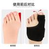 Fabricantes ortesis para hallux valgus del dedo gordo del pie separador de dedos de aluminio fijado para hallux valgus ortesis para pulgar masculino y femenino