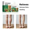 Crema Nutritiva para Piernas Transfronteriza Sin Marca para Aliviar Venas Varicosas y Reparar Crema de Masaje para Cuidado de Uso Externo 100g