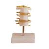 Estoque Limpo Weiye modelo esquelético vértebra cervical modelo humano pé descalço pelve display de ensino display experimental