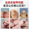 Gel Antibacteriano para Unhas Tipo Caneta para Proteção e Manutenção das Unhas Tudo-em-Um, Não Precisa Remover as Unhas, Reparo e Substituição das Unhas