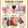 Líquido de Moxibustión Miao, Bola Rodante, Líquido Calentador y Penetrante para la Columna Cervical, Relajante de Tendones y Activador de Colaterales, Aceite para Masaje para el Dolor, Líquido de Moxibustión de Dragón, Procesamiento OEM
