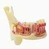 Modelo de Disección de Tejido Óseo Mandibular Modelo de Entrenamiento para el Cuidado Bucal Modelo de Entrenamiento de Tejido Óseo Mandibular