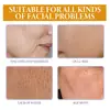 Oceaura Solução para Cuidados Faciais com Vitamina C Hidratante, Hidratante e para Pele Facial Translúcida