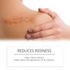 Bálsamo Hidratante para Cicatrices en la Piel, Crema Hidratante para Suavizar y Rejuvenecer la Apariencia de Cicatrices en Cara y Cuerpo, Bálsamo de Cuidado Diario