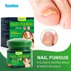 Sumifun Gesso Transfronteiriço Amazon Creme para Cuidados com a Saúde de Onicomicose Creme para Cuidados com a Saúde de Onicomicose em Estoque K10287