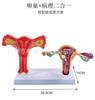 Modelo patológico uterino femenino estructura uterina ovárica materna y reproductiva Anatomía simulación avanzada modelo uterino mórbido