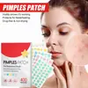 Parche para Acné Transfronterizo para Cubrir Acné, Parche para Acné para Reparar la Piel, Marcas de Acné, Cicatrices de Acné, Imperfecciones, Parche para Acné Desvanecedor, Listo para la Venta
