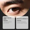 Crema para Ojos para Hombre East Moon Cuida Suavemente la Piel Delicada Alrededor de los Ojos Esencia Hidratante para Ojos Crema para Ojos