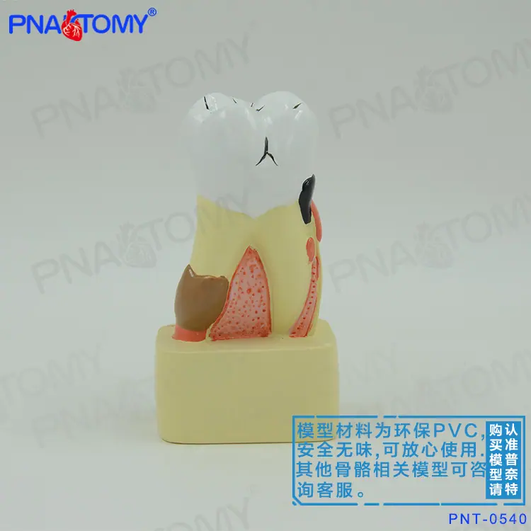 小病理牙02