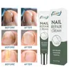 Creme para Cuidado das Unhas Eelhoe Solução para Problemas nas Unhas Cuidado para Mãos e Pés Espessamento Limpeza e Suavização de Problemas nas Unhas Creme para Unhas