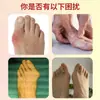 Parche Guoyao Shijia para Juanetes, Parche para Puntos de Acupuntura, Parche para Articulaciones, Parche para Prominencia del Dedo del Pie, Parche para el Dedo Gordo del Pie, Disponible para Venta al por Mayor y Dropshipping