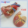 Pnt-0724 Modelo de Corazón 4 Etapas Vaso Sanguíneo Patología Arterial Anatomía Cardíaca Cardiovascular Pantalla Materiales Didácticos
