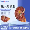 Modelo de Riñón con Aumento Anatomía del Riñón con Modelo de Anatomía Médica Humana Modelo de Aumento de Glándula Renal para Enseñanza y Entrenamiento