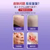 Ungüento Antibacteriano para Picazón en Todo el Cuerpo por Hierbas Dermatitis Persistente Picazón Seca y Húmeda Japonesa Desintoxicación Ungüento Anti-Picazón de Cuero de Vaca