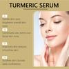 Esencia Calmante de Cúrcuma Hoygi Esencia Hidratante y Humectante para el Cuidado Facial