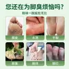 Spray Antibacteriano para Olor de Pies y Piel Descamada de Yunnan, Crema Antifúngica para Pies, Spray Antipurito para Pies para Pies Malolientes, Sudoración, Pies con Picazón y Ampollas