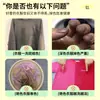 Agente Fixador e Clareador de Cor para Roupas Preto Roupas Coloridas e Calças Bloqueio de Cor Agente Redutor Anti-Desbotamento Agente de Reparo e Renovação de Desbotamento