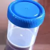 O Copo para Coleta de Escarro Médico Kehua é Resistente a Altas Temperaturas e Alta Pressão, Não Deforma, e a Capacidade do Corpo do Copo é Claramente Marcada e Fácil de Ler e Escrever