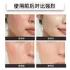 Aceite Esencial de Rosa Facnurt Suaviza y Repara la Piel, Nutre e Hidrata la Piel con Aceite, y Proporciona Cuidado Hidratante para el Rostro y el Cuerpo