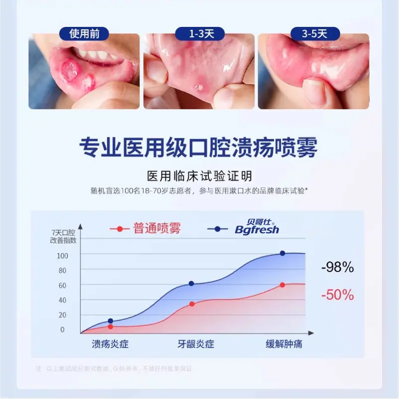 口腔溃疡喷剂1