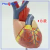 Pnt-0724 Modelo de Corazón 4 Etapas Vaso Sanguíneo Patología Arterial Anatomía Cardíaca Cardiovascular Pantalla Materiales Didácticos