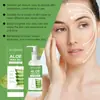 Gel de Aloe Vera Jaysuing Cuidado Suave Hidratante de la Piel Después del Sol Calmante de la Piel Gel Hidratante de Aloe Vera