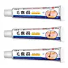 Inflamação do Folículo Piloso Zhengtalin, Coceira na Pele do Folículo Piloso, Espinhas na Cabeça, Acne no Couro Cabeludo, Creme para Folículo Piloso Atacado