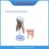 Para fabricantes médicos fornecimento direto de dentes biônicos humanos modelo de ensino odontológico coluna de dente e modelo de anatomia de dente de moagem