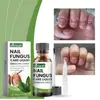 Kit de Cuidado para Unhas das Mãos e Pés Ximonth Cuidado para Unhas dos Pés Onicomicose Clareamento e Suavização Solução para Cuidado de Unhas Encravadas