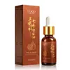 Óleo Personalizado de Notoginseng e Drynaria para Cuidados com as Articulações, Líquido para Moxabustão para Pescoço, Ombro, Cintura e Pernas, Óleo Herbal Calmante e Ativador