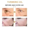 Superventas Transfronterizo Eelhoe Esencia Correctora de Cúrcuma Cuidado Facial Hidratante y Humectante Nutrición Suave para la Piel