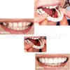 Snap-On- Smile Cuidado de Dentaduras Transfronterizo Brackets Dentales Temporales Creativos Reales y Falsos