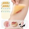 Adesivo Hidrocoloide para Corretivo, Band-Aid, Curativo para Bolhas, Cobertura para Acne, Cobertura para Tatuagem, Curativo Hidrocoloide Autoadesivo