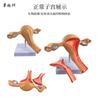 Modelo patológico uterino femenino estructura uterina ovárica materna y reproductiva Anatomía simulación avanzada modelo uterino mórbido