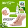 Sumifun Aceite de Árbol de Té Transfronterizo Solución para Onicomicosis, Solución para la Salud de la Onicomicosis, Venta al por Mayor de Comercio Exterior Shopee Lazada K60062