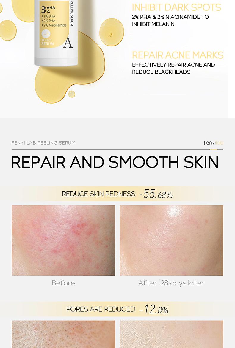 芬逸-三酸精华-详情_04.jpg