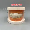 Modelo ortodôntico dental modelo autoligante de cermet oral display de comunicação médico-paciente ambulatorial modelo dental de ensino
