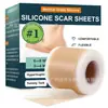 Folhas de Silicone para Cicatrizes Transfronteiriças: Capa de silicone para cicatriz, adesivos de cicatriz suaves e invisíveis