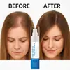 Essência para Cabelo Transfronteiriça 25g Múltiplos Pacotes Sérum Roll-On para Crescimento Capilar Embalagem Neutra