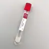 Suministrado Directamente por el Fabricante, Tubos Desechables para Recolección de Sangre Prp con Vacío Acdgelbiotin Tratamiento para la Caída del Cabello Tubo de Recolección de Sangre Prp de Vidrio