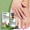 Set de Cuidado de Uñas de Manos y Pies Ximonth Solución para el Cuidado de Uñas de los Pies