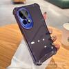 Para funda de teléfono móvil Huawei nova13 12 viene con película para lente 9se galvanoplastia 8 cuatro esquinas anticaída 6 enjoy 70X soporte