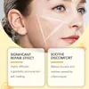 Crema para el Cuidado de la Piel con Veneno de Abeja Houkea Limpieza Suave Elimina Lunares Hidratante Piel Suave Crema de Cuidado Calmante Transfronterizo