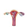 Modelo patológico uterino femenino estructura uterina ovárica materna y reproductiva Anatomía simulación avanzada modelo uterino mórbido