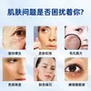 Dispositivo Abrangente para Gerenciamento da Pele para Limpeza Facial, Remoção de Cravos, Equipamento de Beleza com Bolhas Grandes, Firmador e Levantador, Limpeza Profunda